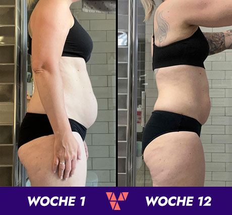 BalanceVit-Transformation-AnitaHass
