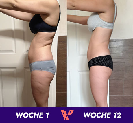 BalanceVit-Transformation-LenaStein